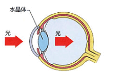 正常な眼球